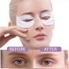 ILISYA Circulation Shape Night Sleeping Eye Mask | Gel Moisturizing Eye Patches for Dry Skin Hydrating Eye Mask 5 Pairs - Image 6